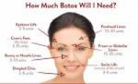 Botox Treatment in London | Beauty Express