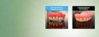 The Smile Centre: Cosmetic Dentistry : Natural Looking Dentures ...