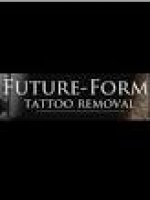 Private Tattoo Removal Bristol - Check Prices and Compare Reviews