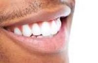 Tooth Whitening - Almondsbury & Yate Dental PracticesAlmondsbury ...