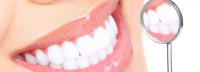Teeth whitening in your own