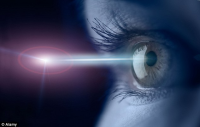 UK have laser eye surgery