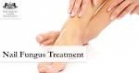 Nail Fungus Treatment (Onychomycosis) | The Harley Laser Specialist