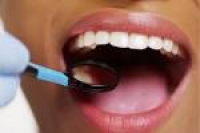 Dentures & Dental Bridges Swindon - Highworth Dental Care