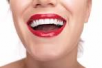 Laser Teeth Whitening | Odonto | Pinterest | Teeth whitening ...